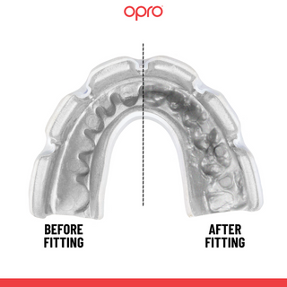 Opro Instant Custom Fit for Braces Clear before and after fitting