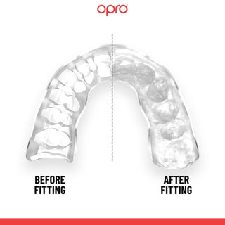 Protège-dents Opro Instant Custom-Fit Silver dents 